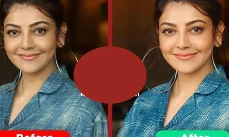 Perbandingan foto sebelum dan sesudah menggunakan aplikasi Remini