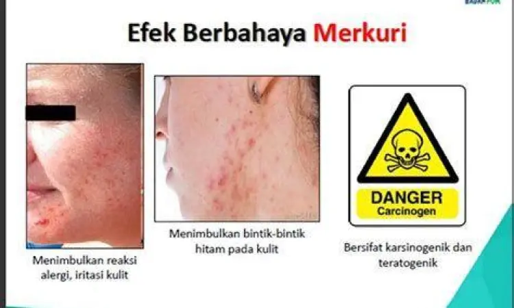 Dampak penggunaan kosmetik berbahaya tanpa izin BPOM